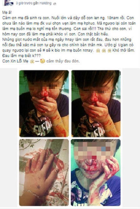 Thiếu nữ tung ảnh mặt đầy máu để “báo hiếu” với mẹ